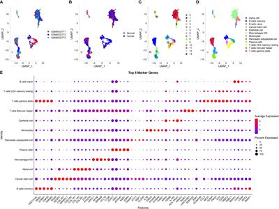 Discovering a Four-Gene Prognostic Model Based on Single-Cell Data and Gene Expression Data of Pancreatic Adenocarcinoma